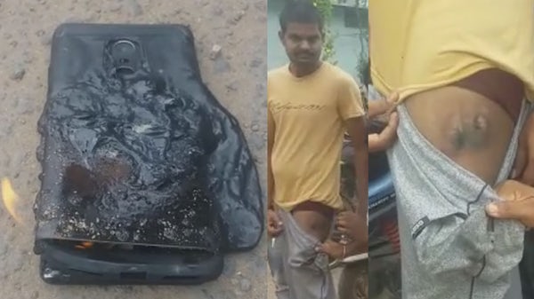 手机tf卡，[视频] 购机 20 天红米 Note 4 意外起火 造成印度男子二度烧伤